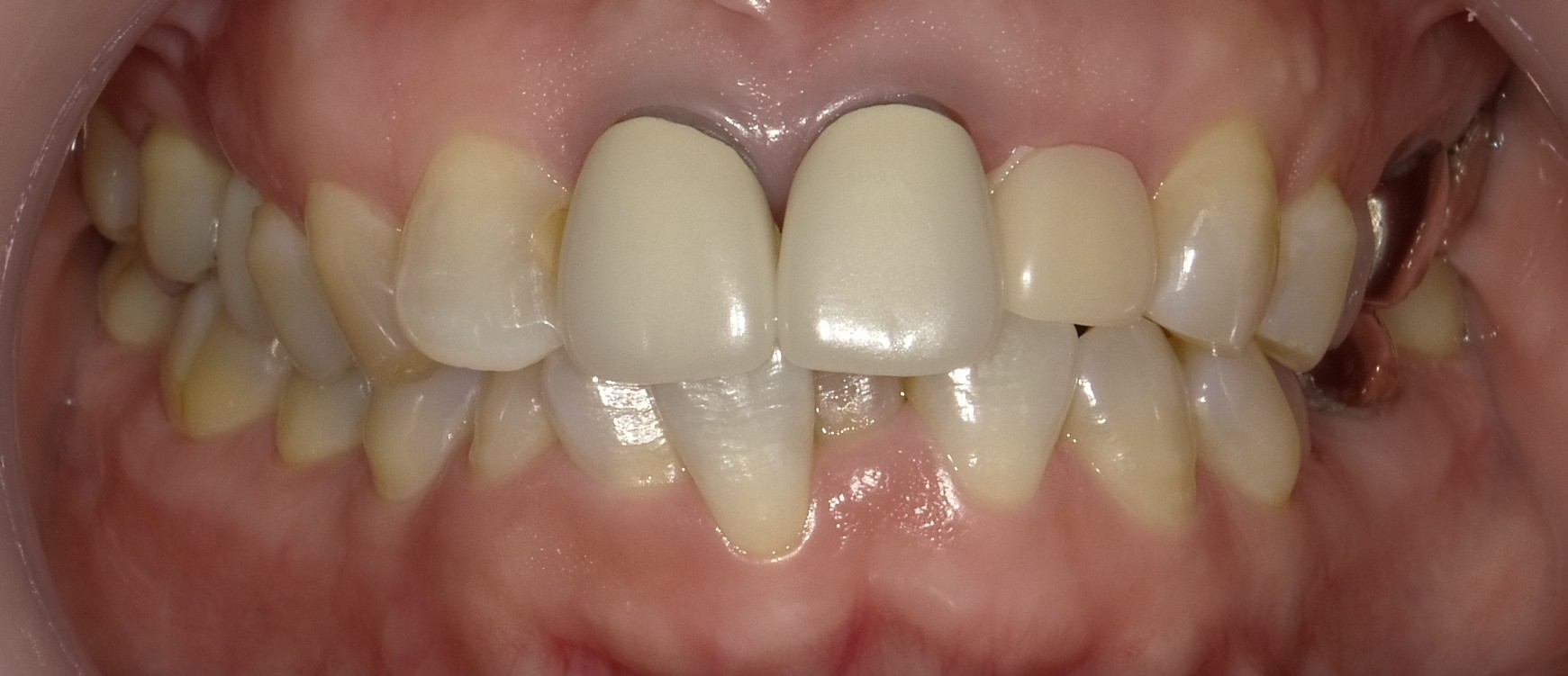 Before image