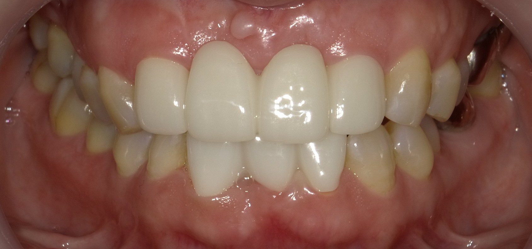 After image