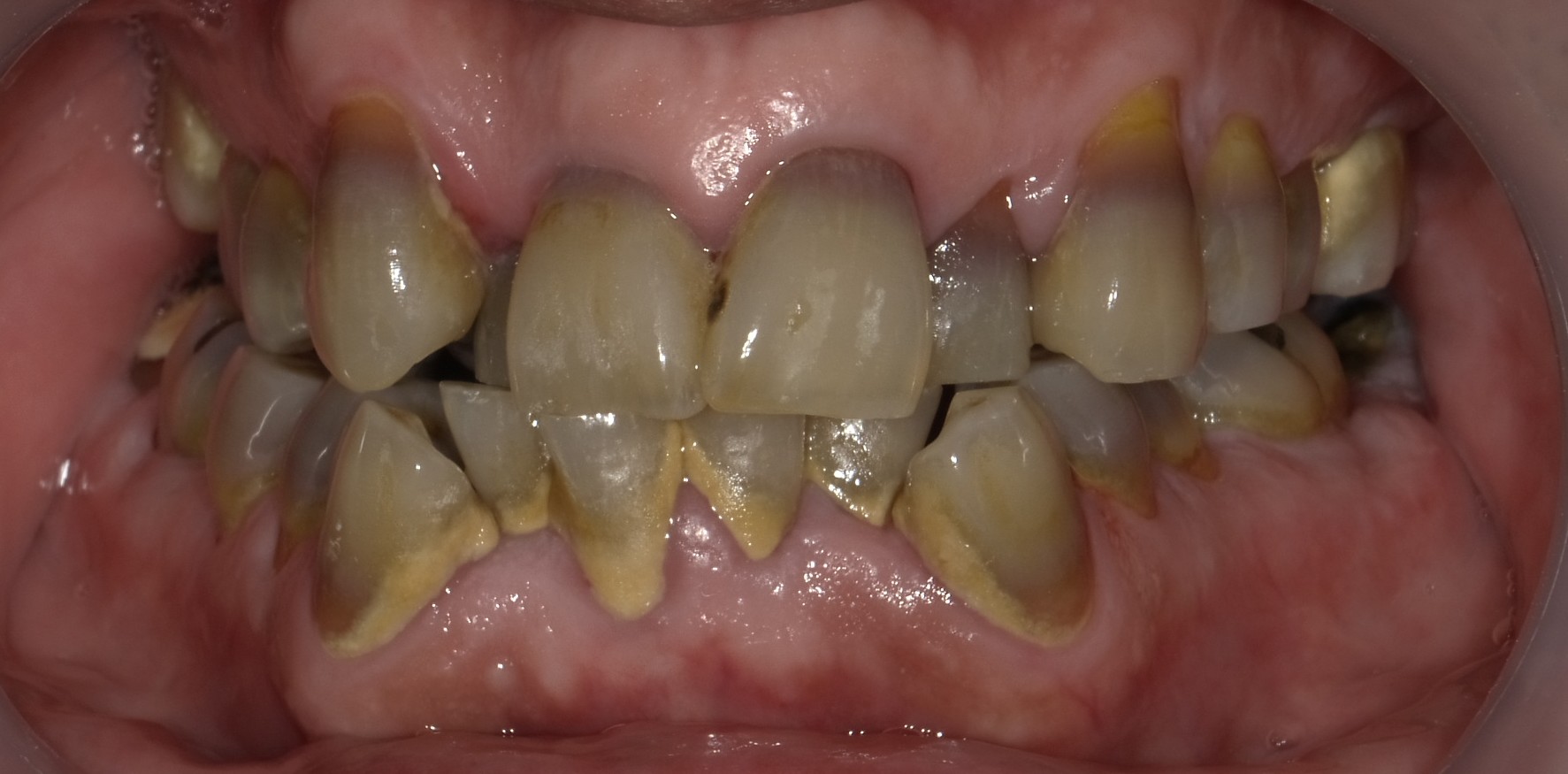 After image