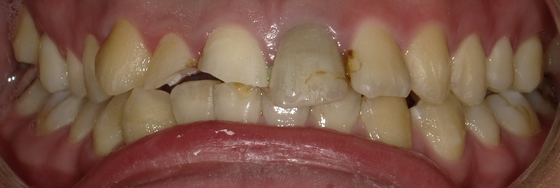 Before image