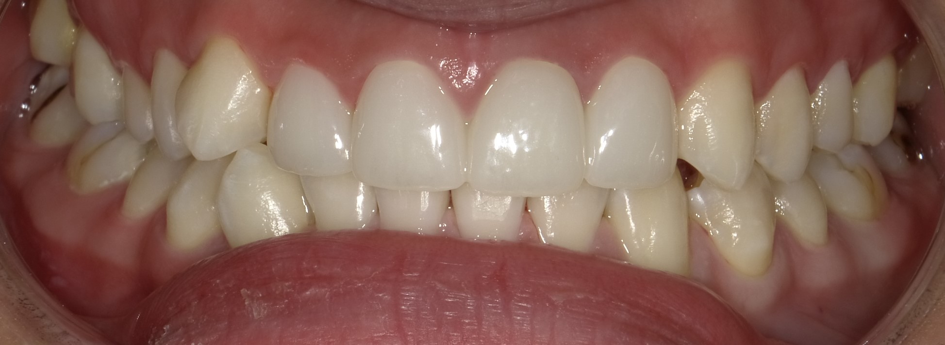 After image
